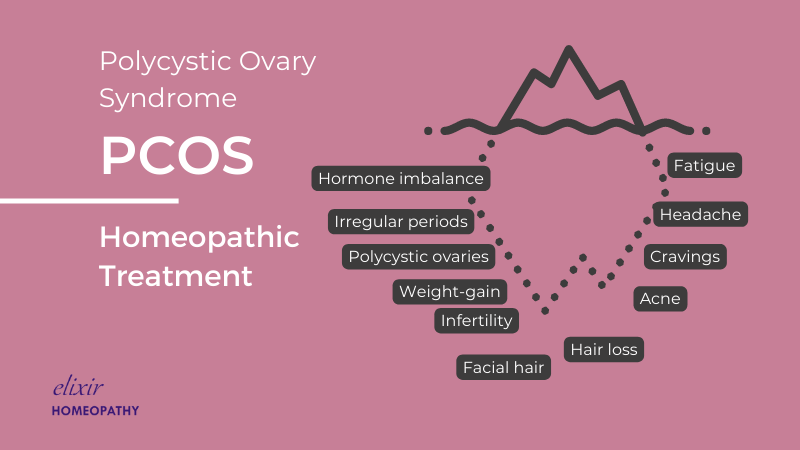 Featured image for article on "Homeopathic Treatment for PCOS Problems". Written by Dr. Sanchita Dharne at Elixir Homeopathy Delhi and Gurgaon area.