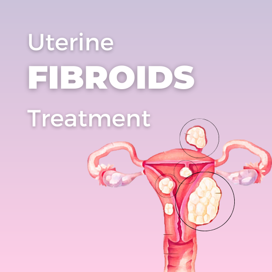 Uterine Fibroids Homeopathic Treatment